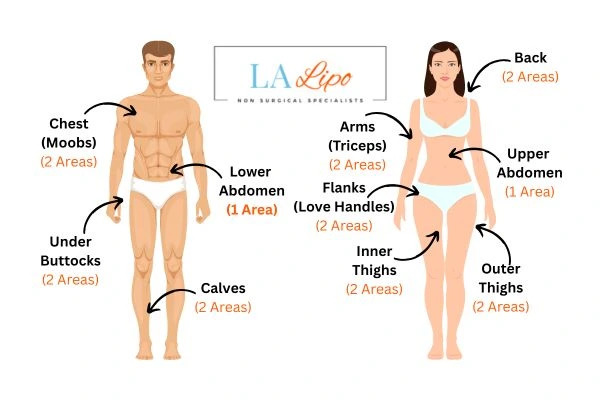 LA LIPO Cryolipolysis Areas Cumbernauld