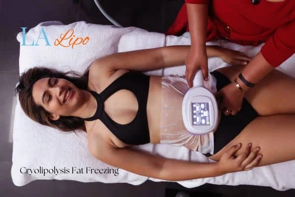 woman getting cryolipolysis Cumbernauld