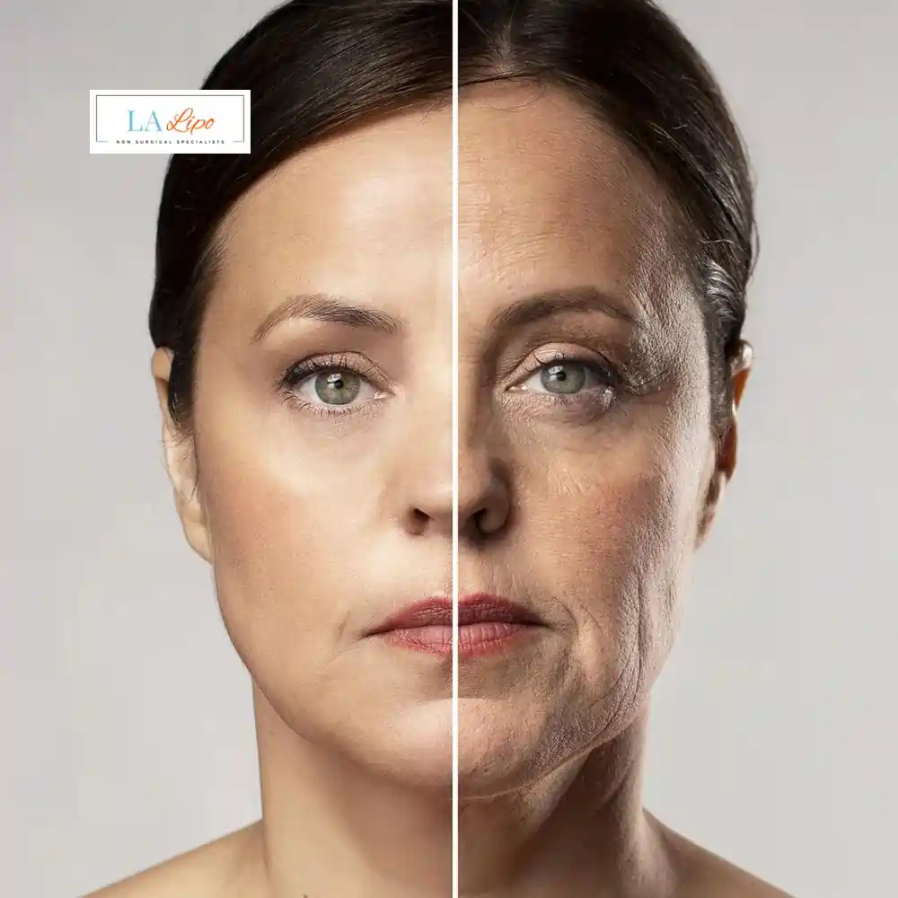 How Can You Tell If Non-Surgical Skin Tightening Is Right for You Cumbernauld?